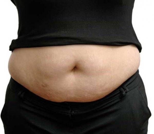 Ilyen leszek, ha nem alszom? Aludj eleget, ha fogyókúrára adod a fejed