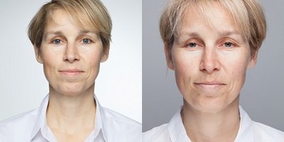 előtte utána Sarah Chalmers